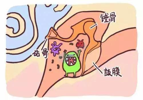 中耳积液，你们知道多少？