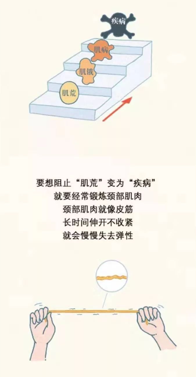 颈椎直了要怎么动作才会好 0e64c42bfe88497d9b5bdae873cde410.jpeg