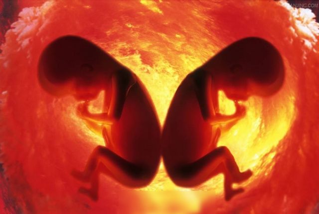 孕期体重如何控制？单胞胎和多胞胎差别大！怀孕后，你最担心什么
