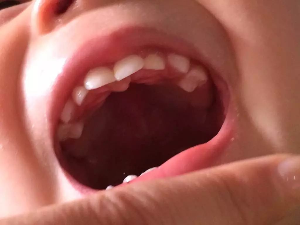 详解：宝宝的长牙时间，一张图让你秒懂宝宝长牙顺序！|