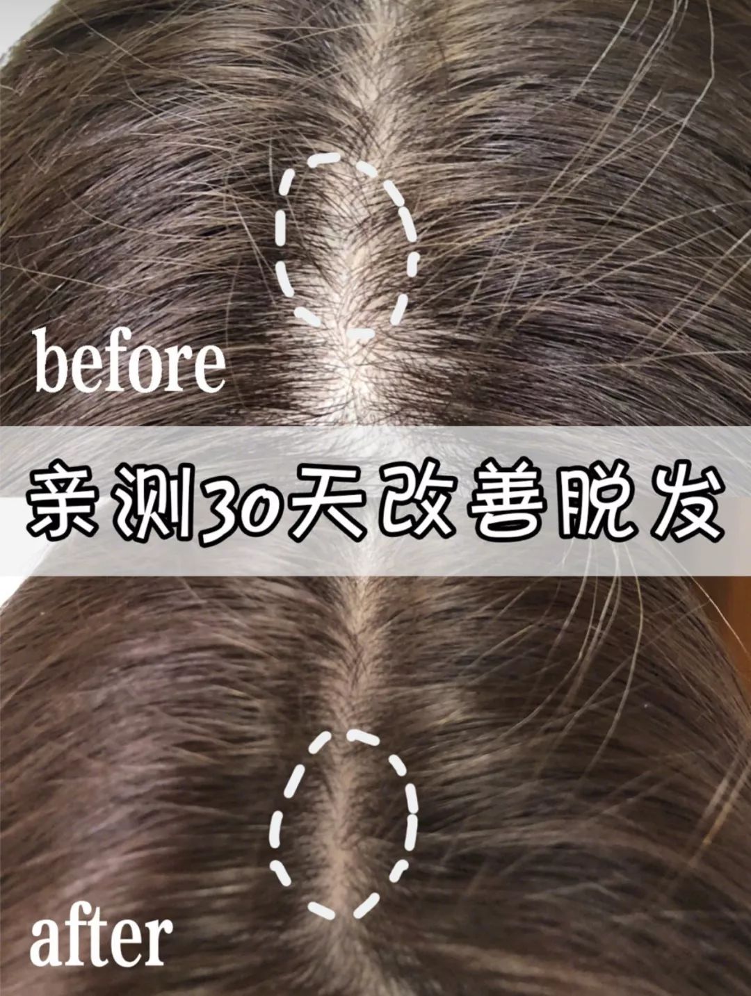 一般多久洗头发 977677c82a2c456680b261f3704df9bb.jpeg