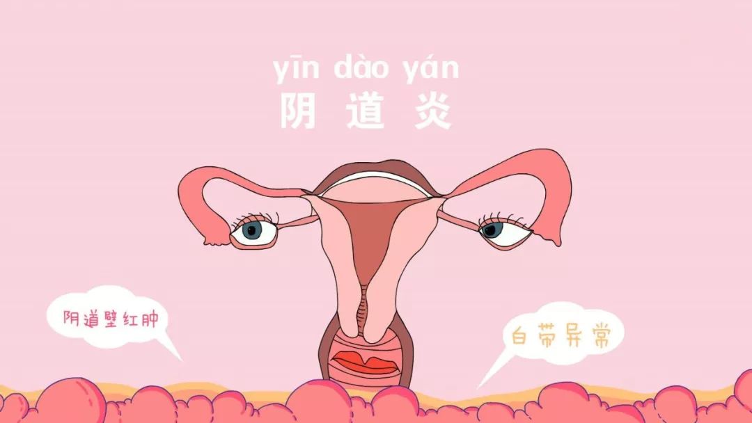 荆州江京妇科医院 ▏为什么你的阴道炎总是反反复复?