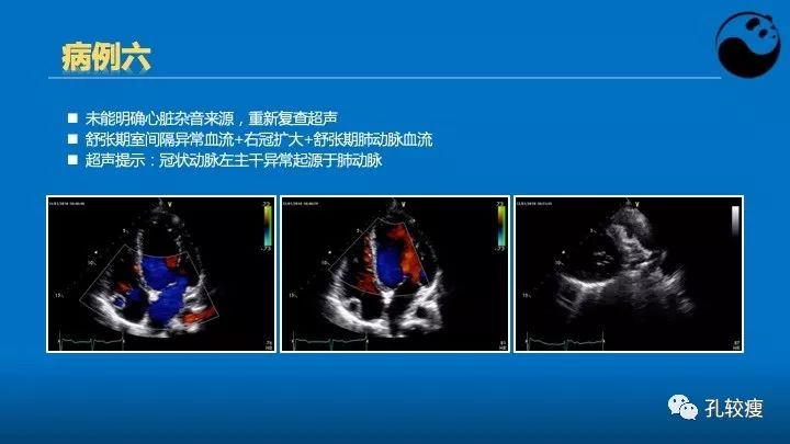 心脏介入医生应该掌握的超声心动图知识