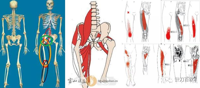 腰方肌与整体力线的关系