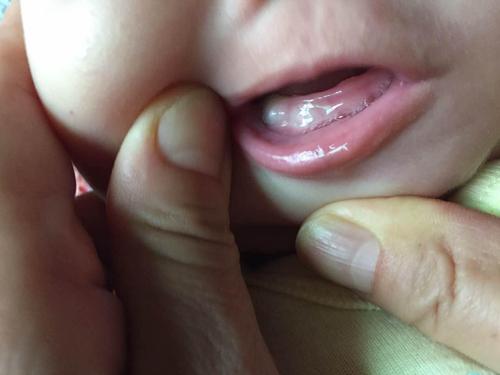 【一周岁的宝宝长牙慢，是缺钙，还是营养跟不上？】 