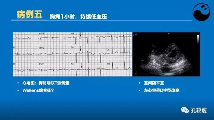心脏介入医生应该掌握的超声心动图知识