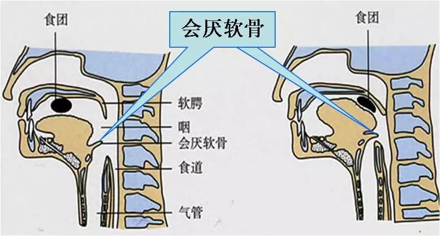 会厌软骨"的小家伙.