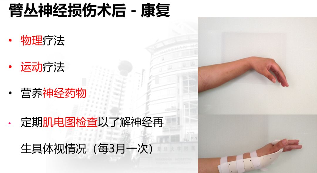 【年会微文精选】手外伤常见手功能康复
