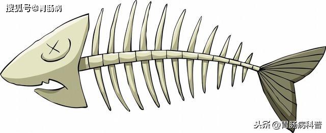 连同鱼刺一股脑儿吞了下去,张先生老婆看看,好像有一根鱼刺卡在里面