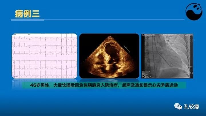 心脏介入医生应该掌握的超声心动图知识