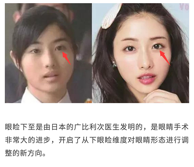 悠悠教你如何拥有日本女星同款无辜眼——眼睑下至