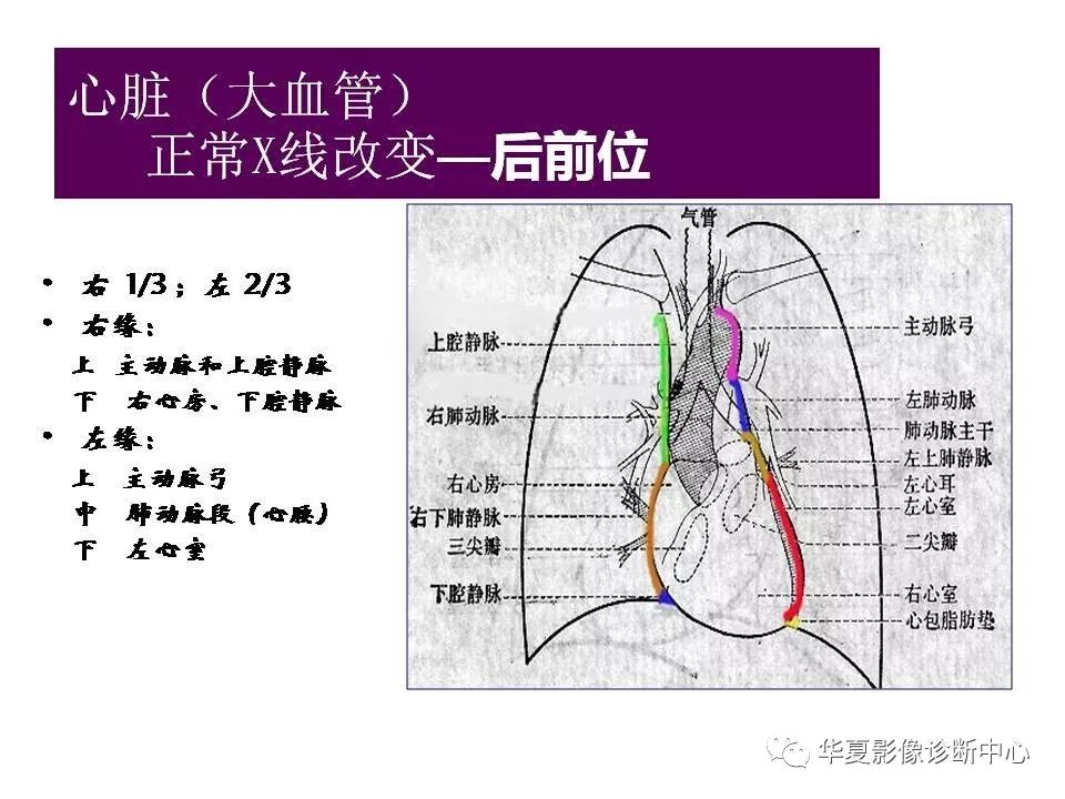 心脏大血管的影像解剖对照