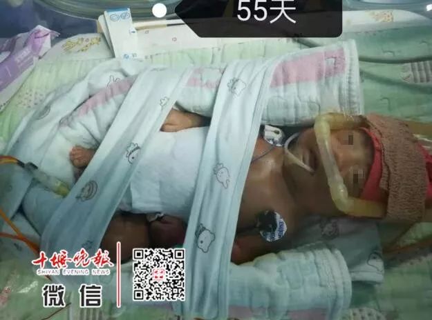 「十堰晚报」十堰妈妈怀孕6个月产下巴掌大女婴！医生拍下14张照片，张张让人落泪.....