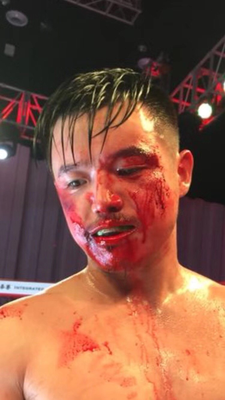 面对平安赖赔案中的“赖赔”，高锋誓要斗争到底