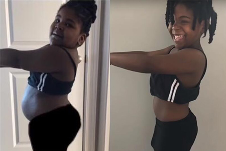 4岁小女孩重达87斤，在妈妈的督促下减肥，看她7个月后身材变化
