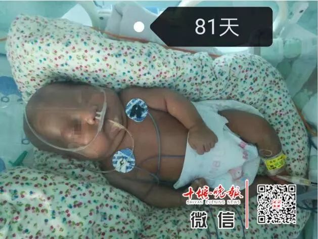 「十堰晚报」十堰妈妈怀孕6个月产下巴掌大女婴！医生拍下14张照片，张张让人落泪.....