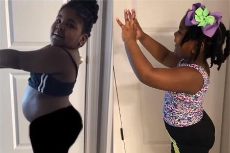 4岁小女孩重达87斤，在妈妈的督促下减肥，看她7个月后身材变化