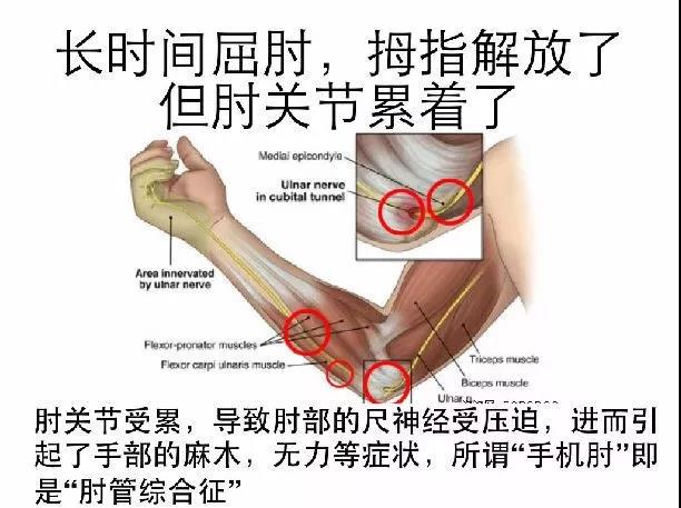 人口手足_人口手足