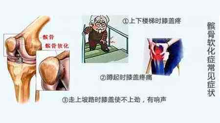 70493c1ec98c4359a819b982a6286ca8.jpeg