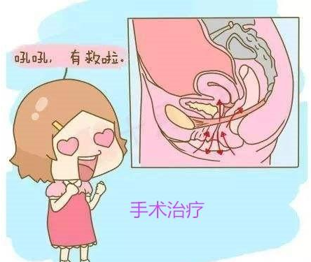 原创为什么产后容易发生尿失禁,如何治疗和调理?