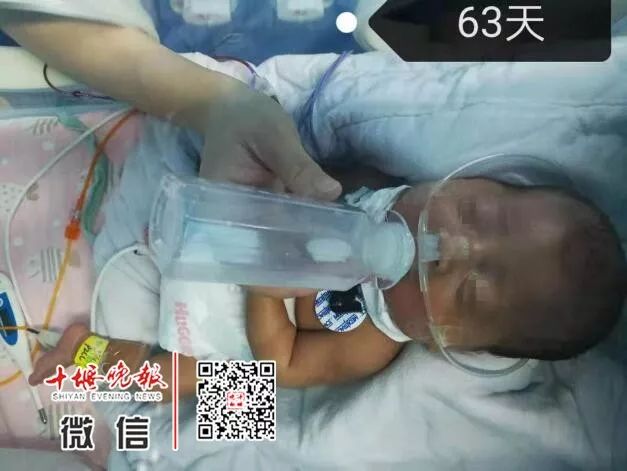 「十堰晚报」十堰妈妈怀孕6个月产下巴掌大女婴！医生拍下14张照片，张张让人落泪.....