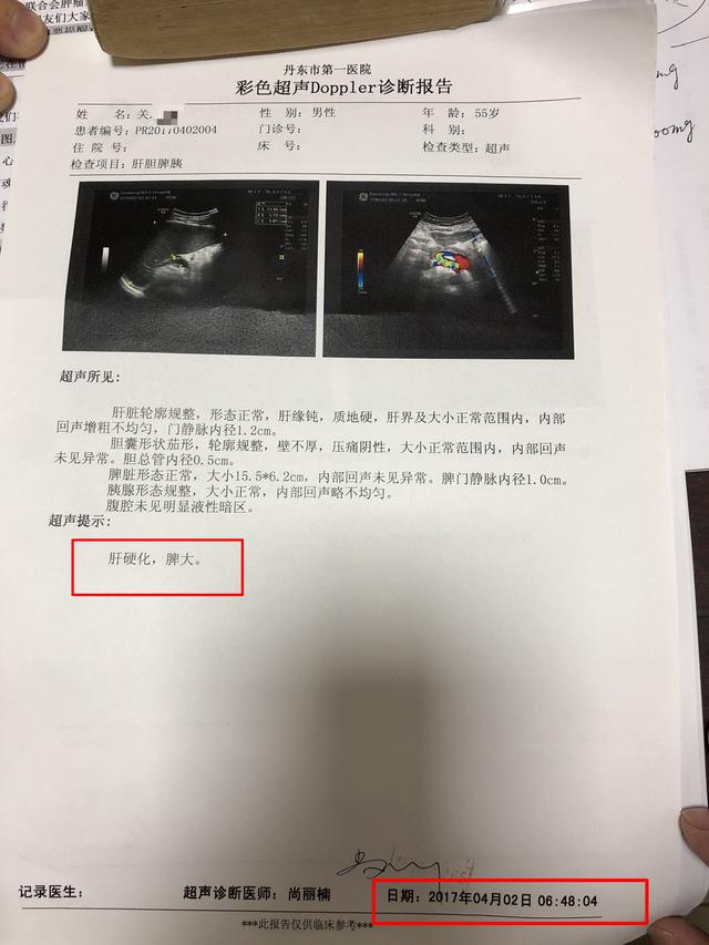 钟伟医生健康谈:肝硬化腹水,别放弃治疗!中医治疗有效