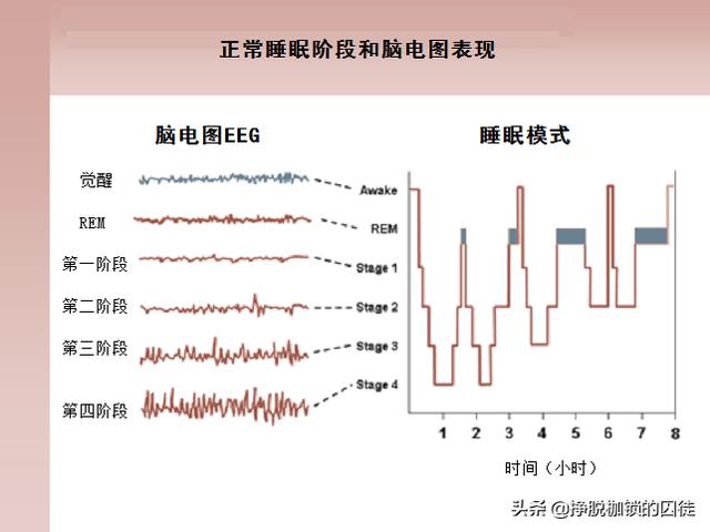 它们会梦到什么?_睡眠