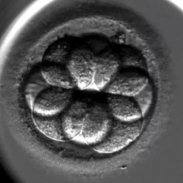 [平时移植的8细胞顶级胚胎长啥样？] 