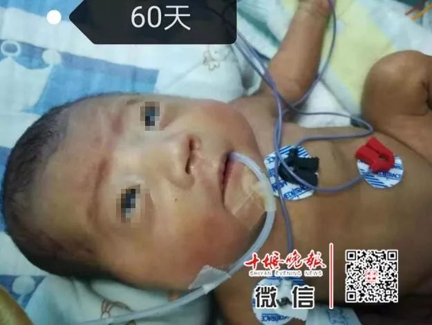 「十堰晚报」十堰妈妈怀孕6个月产下巴掌大女婴！医生拍下14张照片，张张让人落泪.....