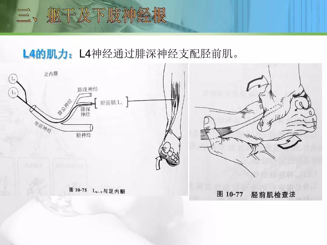 深入细说坐骨神经痛,附送,脊柱神经定位检查