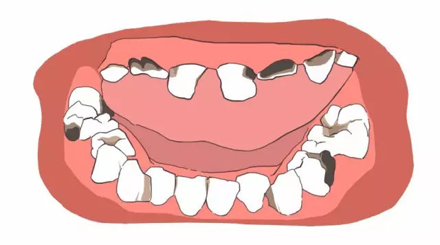 [牙疼了就是蛀牙？不，引起牙痛的原因其实有12种] 