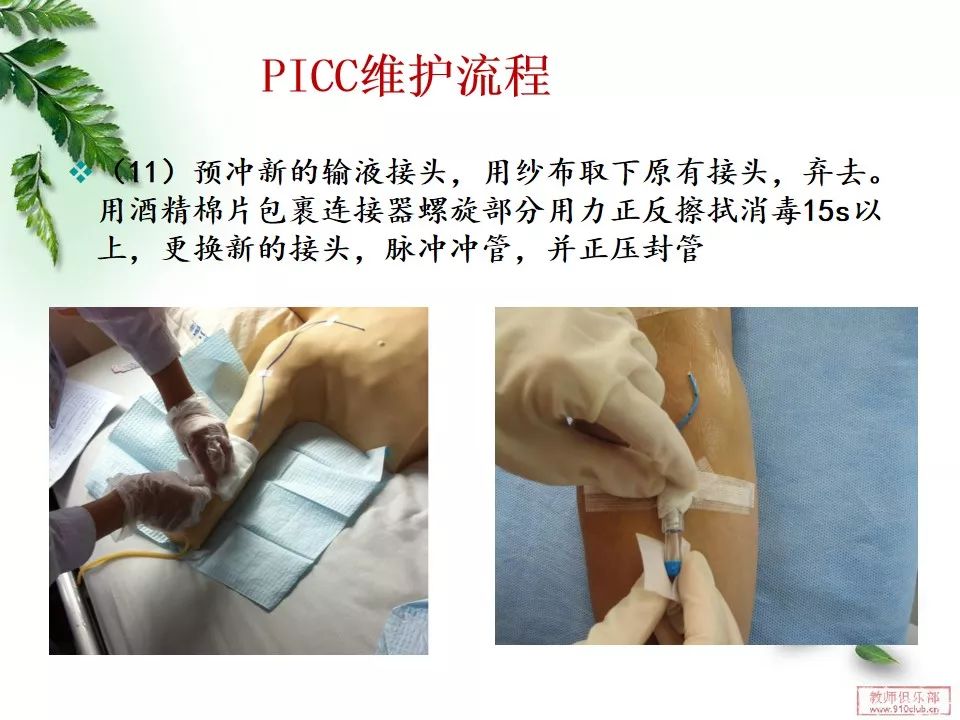 pptpicc导管的维护这篇真的很详细