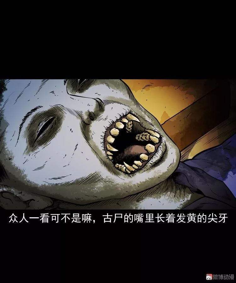 救命啊!僵尸咬人啦!