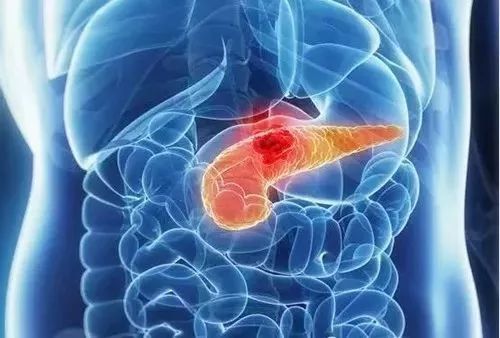 2ae5a2a97d744fabb2aa865481ed76ef.jpeg