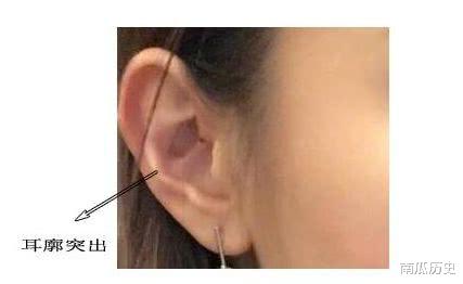 九种不同的耳朵,九种不同的出生,面相耳朵案例详解
