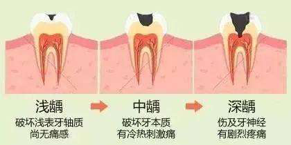 小孩子牙虫吃了怎么办