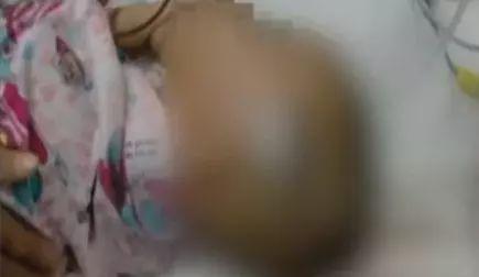 5岁女童被从天而降的躺椅砸中 头骨开裂