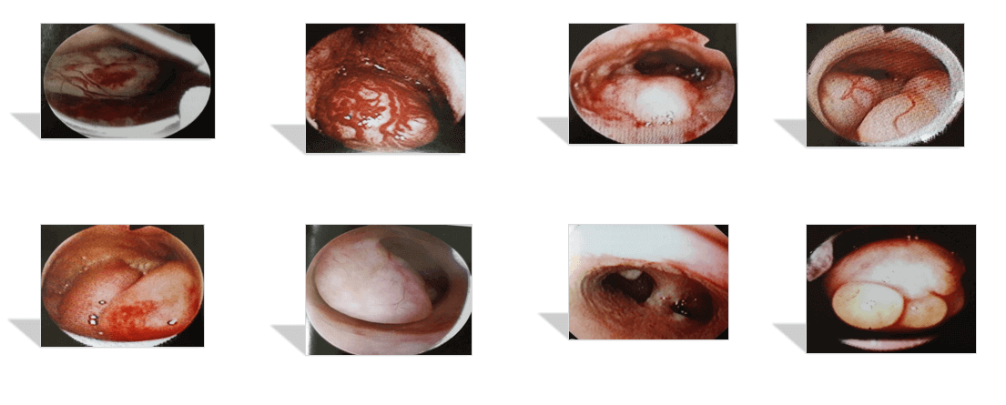 经间出血 5. 不规则阴道出血——"排卵障碍" 6. 月经频发 7.