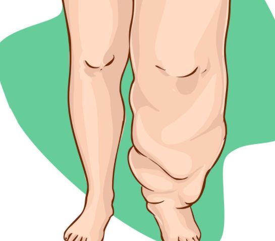 怎样可以减轻肾的负担 0348f481e391426f981643889cf03d9c.jpeg