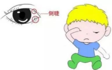 【健康 | 孩子常常眨眼是什么原因？】