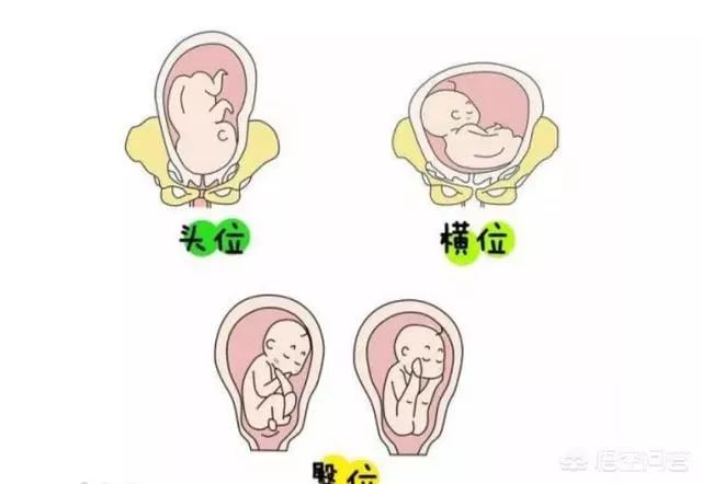 胎儿在哪个月份胎位就固定了，胎位不正怎么办？|