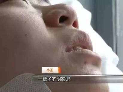 什么是石女什么是刺男 7169a1504d4a45519c4211c86fe2983b.jpeg