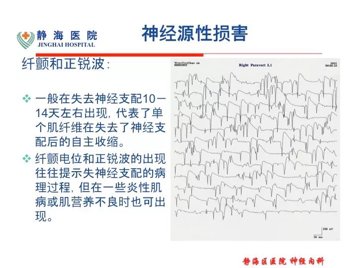 神经源性损害怎么康复 82dc530052cb4eaba1fedde638dc4d6e.jpeg