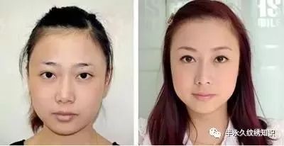 什么方法可以去脸毛 9ec92bb38bb84398be38c68061ebeb61.jpeg