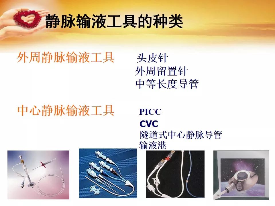 如何合理选择静脉输液工具这些方面容易忽略