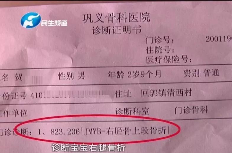 #小莉帮忙#当心！网红蹦床又出事！2岁孩子一瞬间骨折！