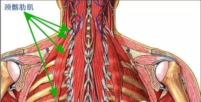 气喘 7,颈椎病 8,颈部功能受限 第三组:肩胛上背部 紧张(缩短)肌肉