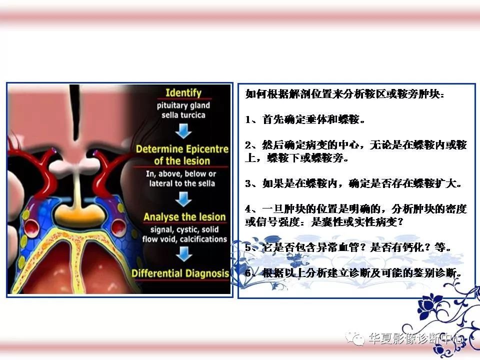 垂体及周围结构解剖与疾病