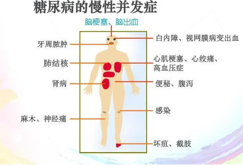 93f46a057a2f4df78b4537151bf83e2e.png