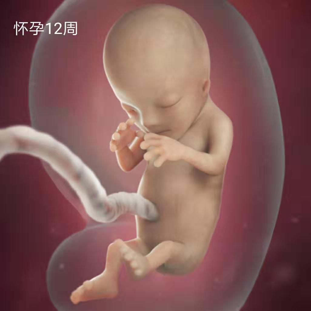 怀孕3个月胎儿变化大：NT图能看胎儿性别？别说，还真有些门道